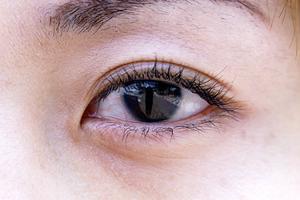 婦人科形成治療を受けたい場合には